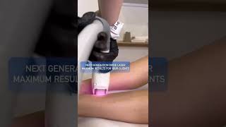 Zemits QUIDION has Quick Dynamic Control Technology to improve diode laser performance #shorts