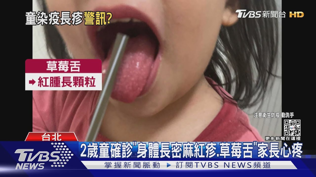 2歲童確診「身體長密麻紅疹、草莓舌」　家長心疼