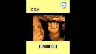 What is 3D and 4D Scan? | add-on Scans and Labs | Ultrasound Scan | Dr. Sunil Kumar G.S