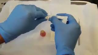 Download lagu Dentsply Dycal Calcium Hydroxide Paste - How To Mix - DENTBEAR mp3