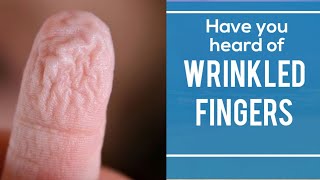 Wrinkled Fingers / Pruney Fingers