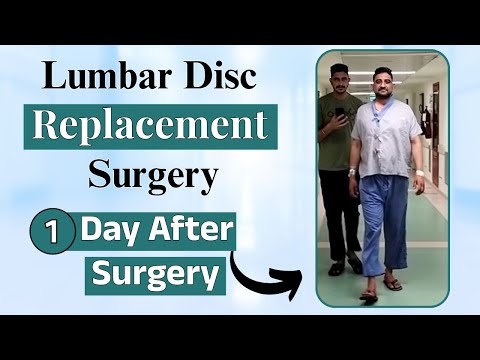 Lumbar Disc Replacement Surgery - 1 day after surgery