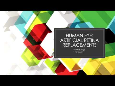 Artificial Retina - UTS Physiological Systems 2020