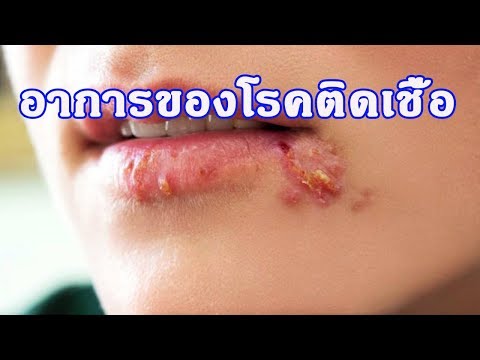 เต้านม implants 275 มล. จุดสีแดงเล็ก ๆ บนหลังและหน้าอก
