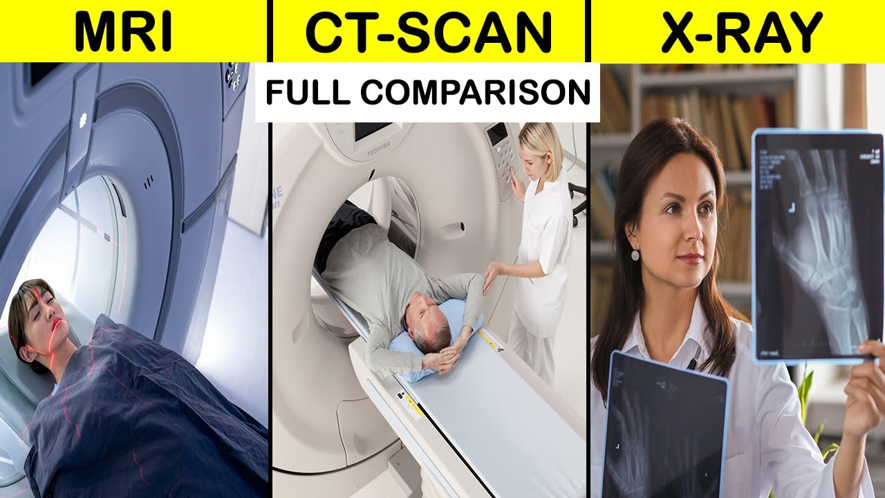 MRI vs CT SCAN vs XRAY Full Comparison UNBIASED in Hindi |