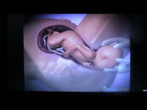 Die Geburt eines Babys