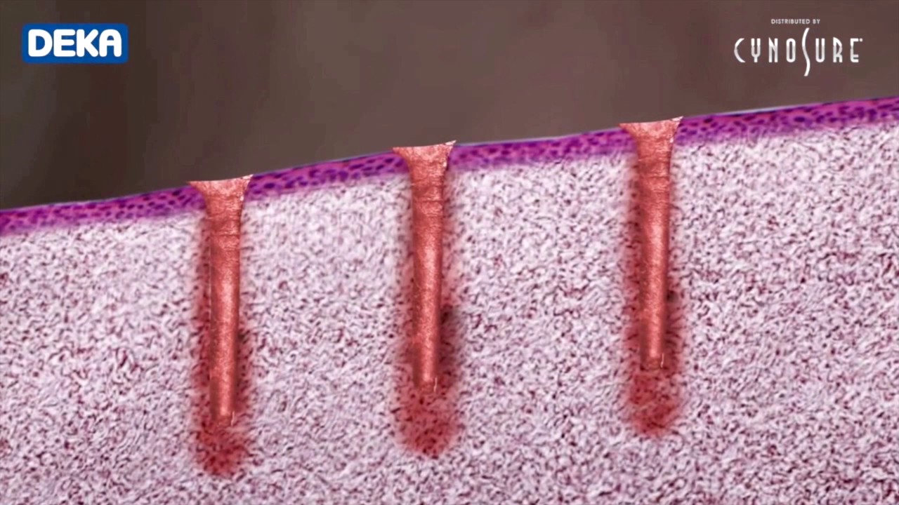 Citlali Quiroz Cruz-10