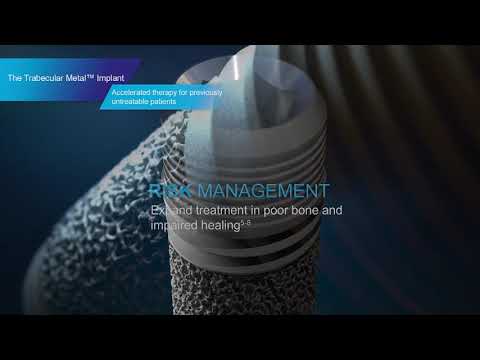 The Trabecular Metal™ Implant