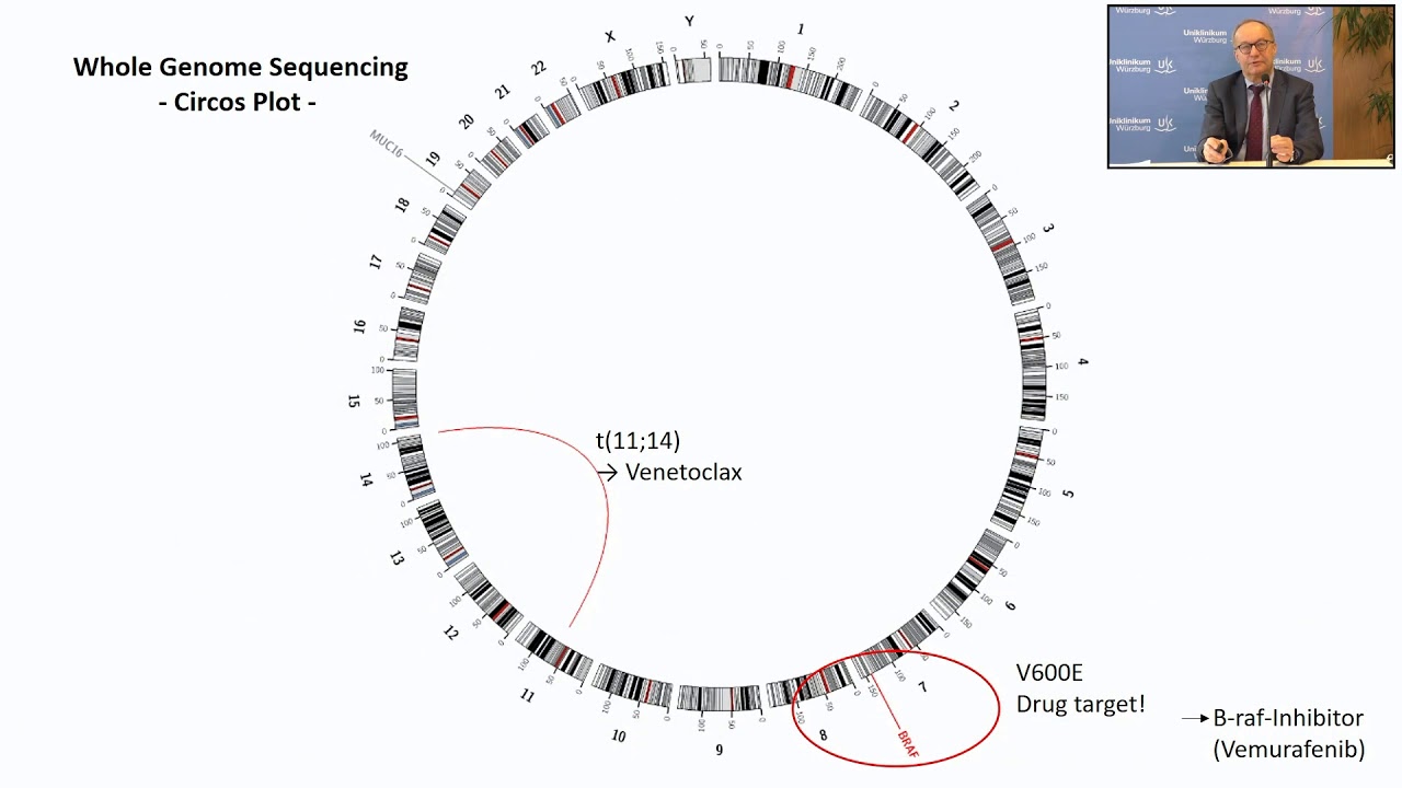 Neue Therapiemöglichkeiten beim Multiplen Myelom 2021