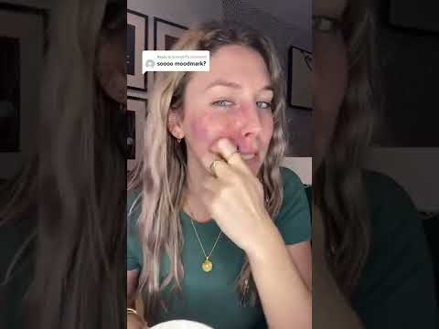 I guess you could call it that... #birthmark #shorts