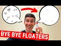 Eye Floaters CURE? - Atropine Eye Drops for Eye Floaters Explained