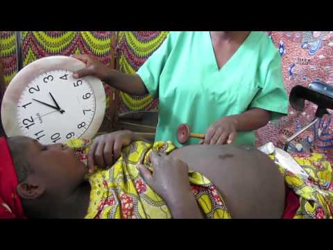 剛果民主共和國的產科護理　Obstetric care in DRC (剛果民主共和國的產科護理　Obstetric care in DRC)
