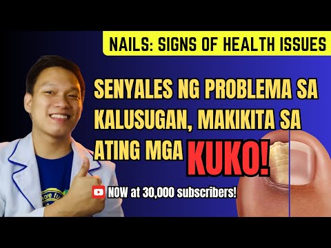 KUKO, maaaring senyales kung mayroon tayong HEALTH ISSUES