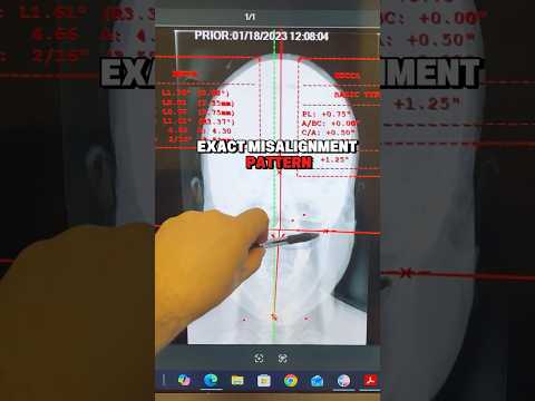 Video thumbnail: What Happens At Your Headache Assessment