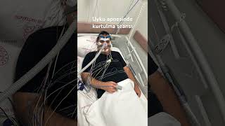 Uyku apnesi çok kötü birşey#sağlık #uykuapnesi #hospital #hastane #tedavi ##sağl