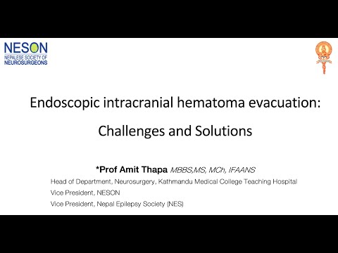 ACNS Webinar Nov 4 Endoscopic Intracerebral Hematoma Evacuation by Prof Amit Thapas