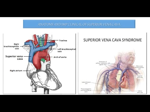 SUPERIOR VENA CAVA # FORMATION/COURSE/ IMP RELATIONS/TRIBUTARIES# SVC ( OBSTRUCTION ,SYNDROME)