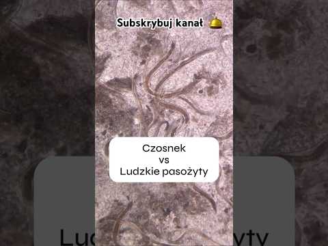 CZOSNEK VS. LUDZKIE PASOŻYTY 🧫🔬🦠 garlic vs. human parasites #laboratorium #eksperyment #science