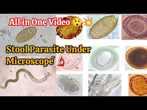 Stool Parasites Under Microscope 🔬💥 All in one video 💥 @MLTclass  #viral #trending #lab #parasite