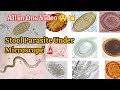 Stool Parasites Under Microscope All In One Video MLTclass Viral Trending Lab Parasite