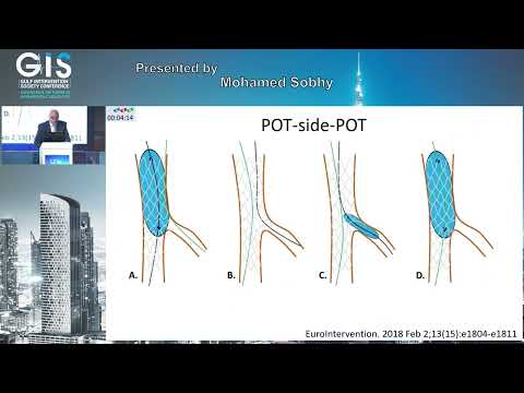 13 Mohamed Sobhy   Bifurcation Stenting  Step by Step Technique