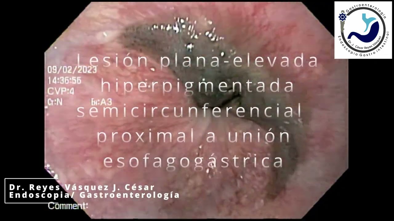 J. César Reyes Vásquez-43