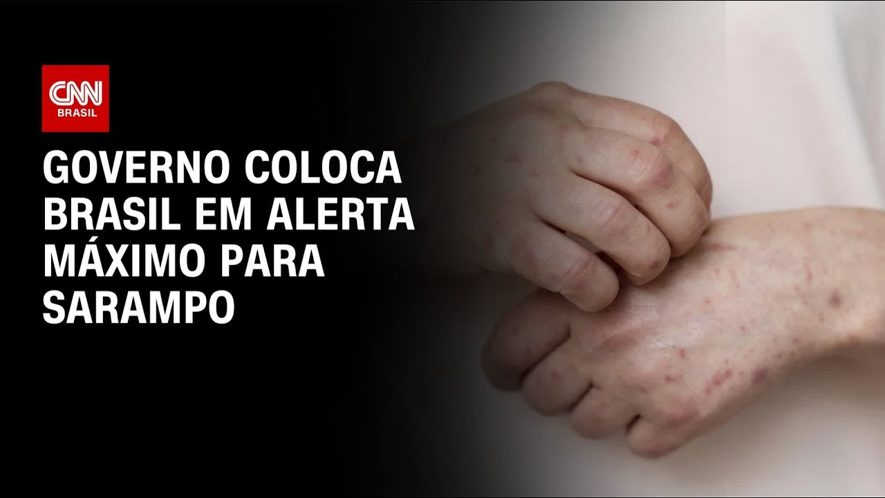 Sarampo: Governo coloca Brasil em alerta máximo | CNN NOVO DIA