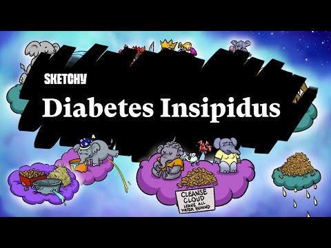 Diabetes Insipidus Symptoms (Part 1) | Sketchy Medical | USMLE Step 2 CK