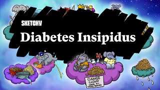 Diabetes Insipidus Symptoms (Part 1) | Sketchy Medical | USMLE Step 2 CK