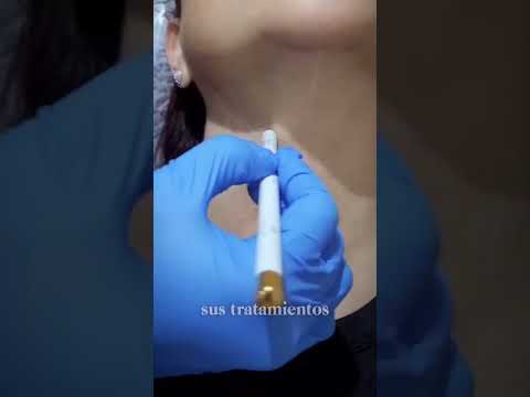¿Qué es la bioestimulación para el cuello? ¡Mejora la calidad, firmeza y textura de tu piel!