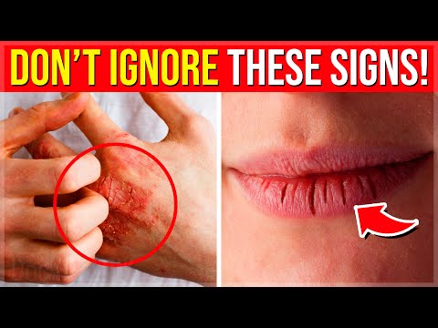 12 WARNING Signs Your Body NEEDS MORE Magnesium Magnesium Deficiency Symptoms