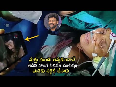 Doctors Performed Brain Operation By Showing Megastar Chiranjeevi Movie | Telugu Varthalu