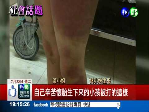 便當倒馬桶 父女友鐵棍抽女童