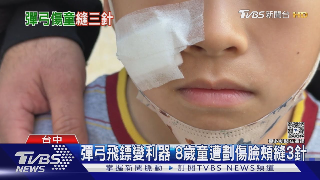 童玩彈弓飛鏢「被劃臉」!塑膠片如美工刀 緊急縫3針