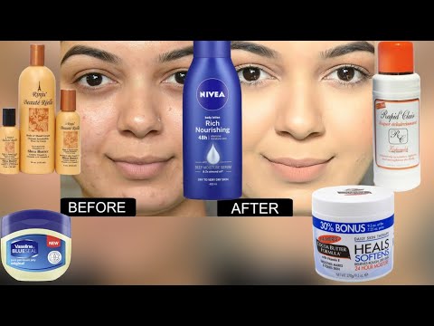 Ondoa VITUNDU USONI | Epuka MAFUTA HAYA | Mambo HATARI kwa AFYA ya NGOZI