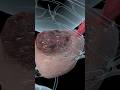 What Is A PSA Test For Prostate Cancer Prostate Specific Antigen Test UC Davis Health Tips