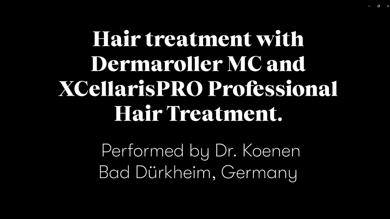 Hair scalp treatment with Dermaroller MC