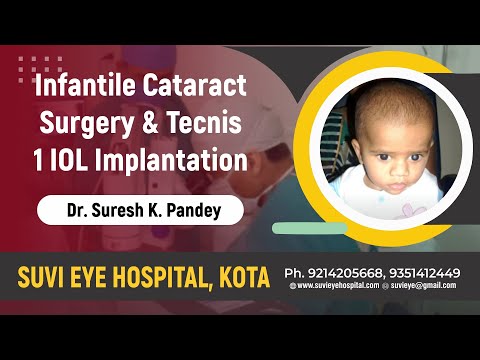 Infantile Cataract Surgery And IOL Implantation