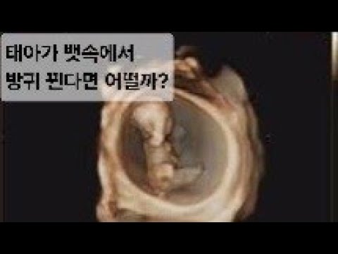 아이콘
