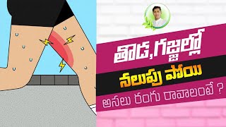 Best #HomeRemedy Ever For Dark Inner Thighs | Beauty Tips In Telugu | #DrManthenaOfficial