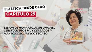 [Est. desde 0] Cap. 29: Sesión de Hidrafacial en una piel....
