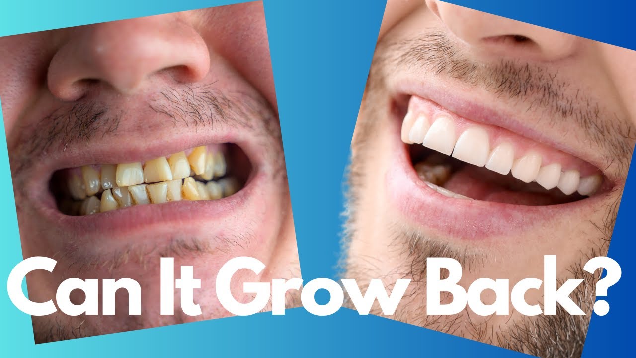 Can Tooth Enamel Really Grow Back? The Truth Revealed!