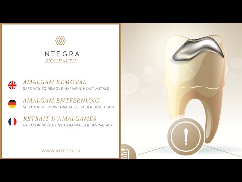 Amalgam fillings | An expert’s opinion | INTEGRA Biohealth