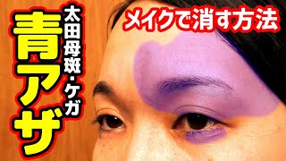 メイクで青アザを消す方法