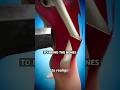 How Broken Bones Are Fixed 😨 Surgeon Reacts