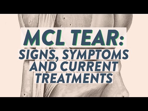 MCL tear: Signs, symptoms and current treatments