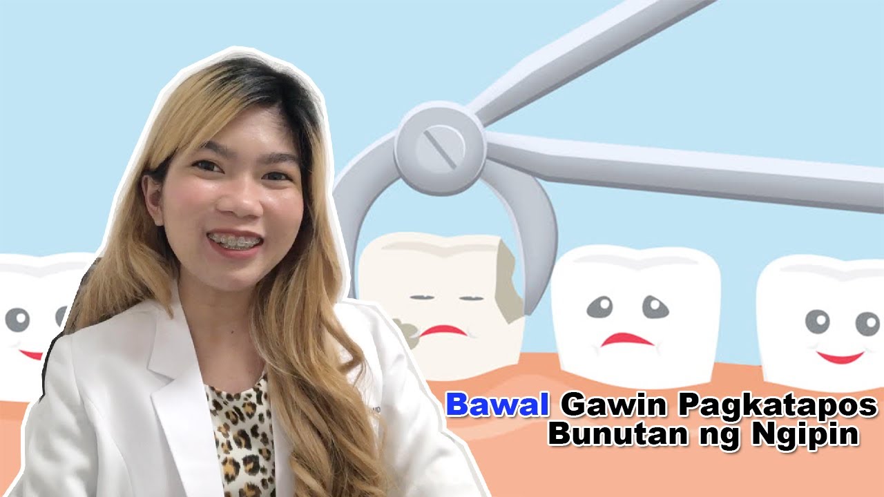 Putar video Bawal Gawin Pagkatapos Bunutan ng Ngipin | Don'ts after Tooth Extraction sekarang Bawal Gawin Pagkatapos Bunutan ng Ngipin | Don'ts after Tooth Extraction