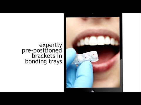 What is Six Month Smiles?