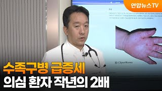 [출근길인터뷰] 수족구병 급증세, 의심 환자 작년의 2배 / 연합뉴스TV (YonhapnewsTV)