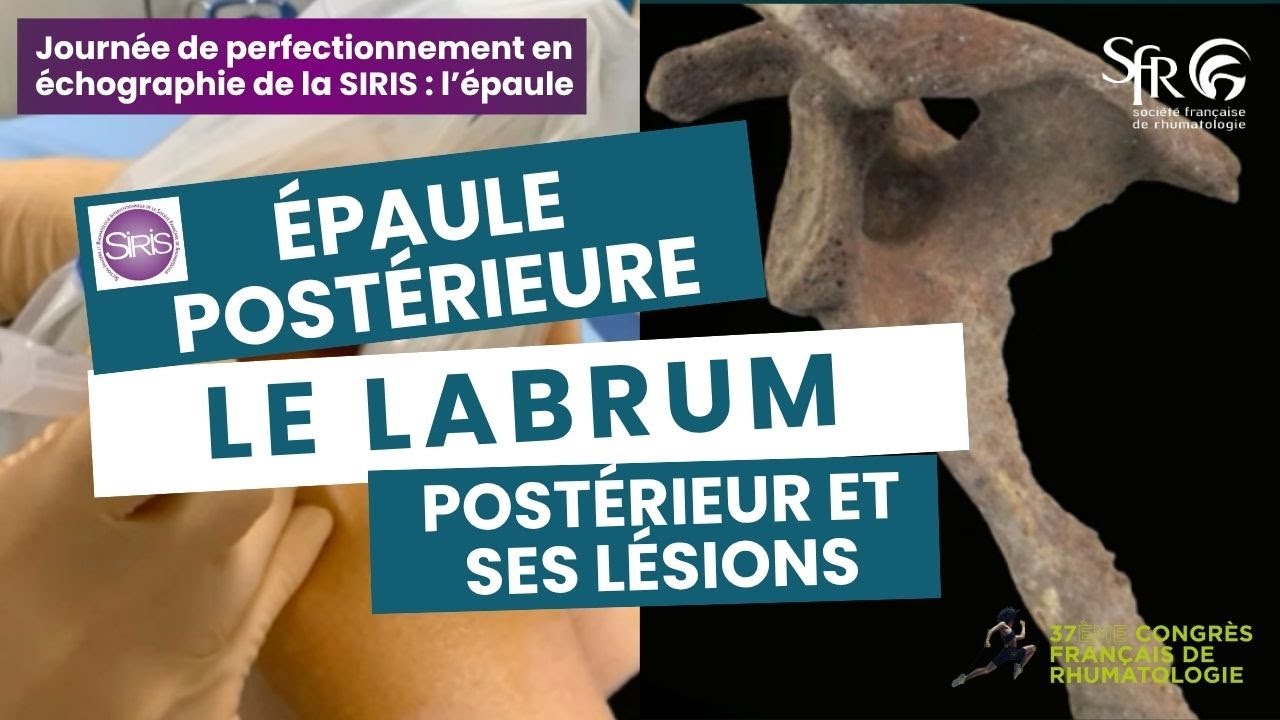 Journée de perfectionnement en échographie de la SIRIS